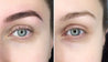 Eyebrow Tattoo Toning or Removal